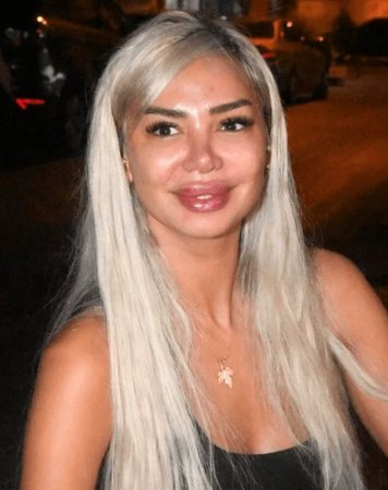 Məşhur rəqqasə tanınmaz halda - Fotolar